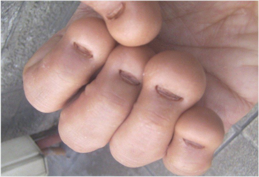 www.momisodes.com_wp_content_plugins_2007_11_ques10_nailbiter.jpg